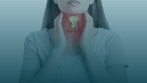 Thyrotoxicosis